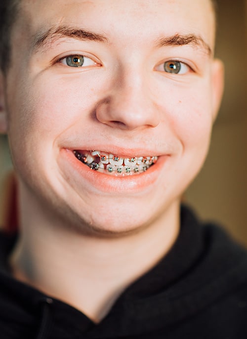 SKS Orthodontics in Fayetteville, North Syracuse, and Fulton, NY